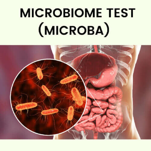 Microbiome test